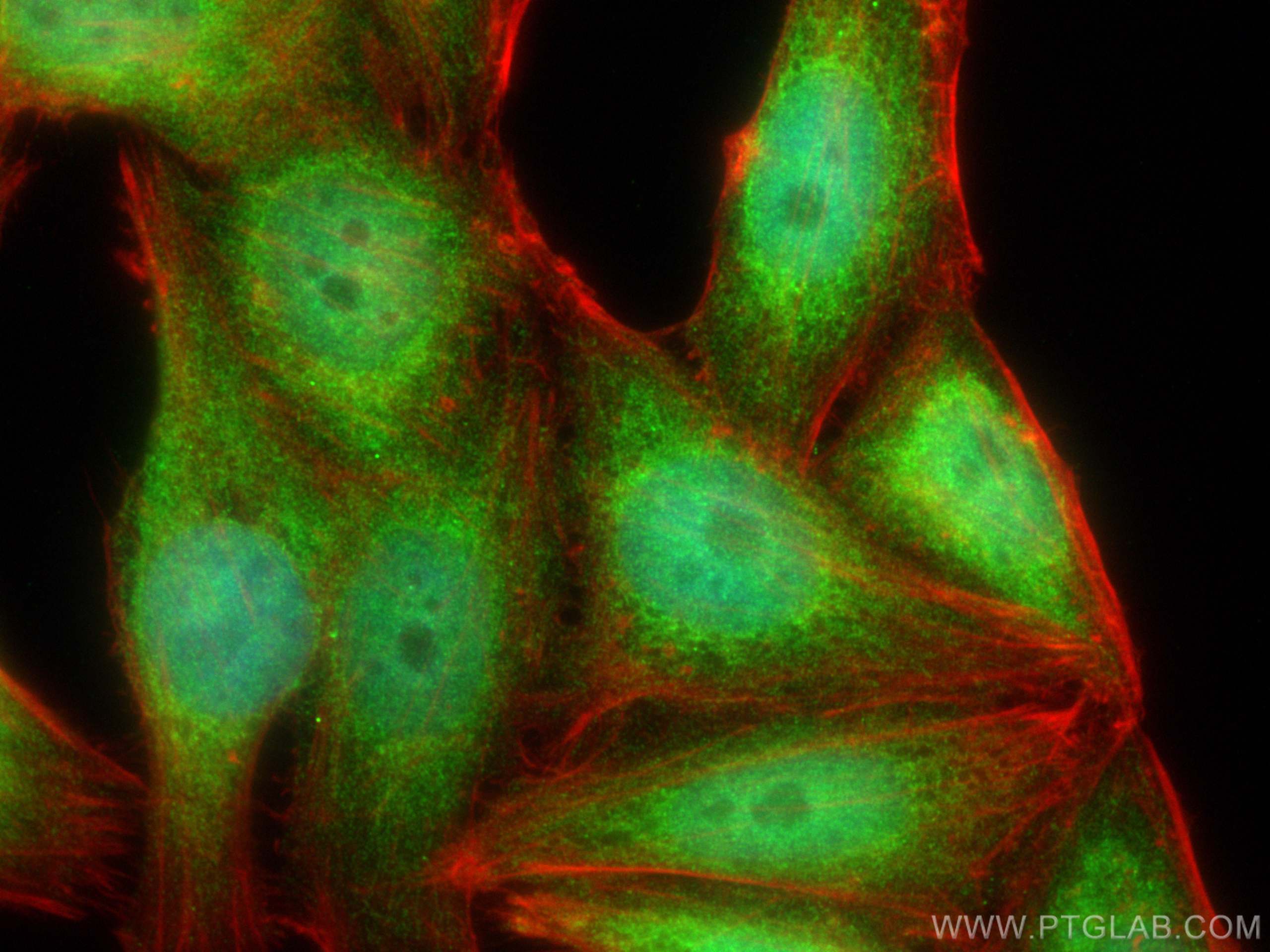 Immunofluorescence (IF) / fluorescent staining of HepG2 cells using NFE2L1 Polyclonal antibody (17062-1-AP)