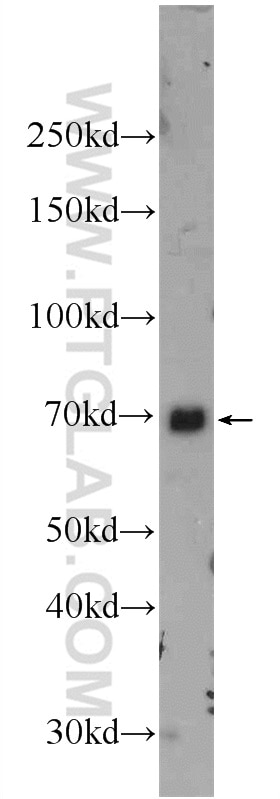 Western Blot (WB) analysis of NIH/3T3 cells using NFE2L1 Polyclonal antibody (17062-1-AP)