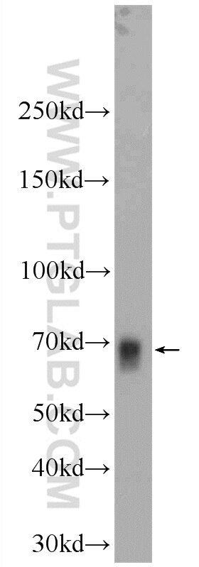 Western Blot (WB) analysis of HEK-293 cells using NFE2L1 Polyclonal antibody (17062-1-AP)