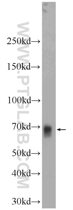 WB analysis of HEK-293 using 17062-1-AP