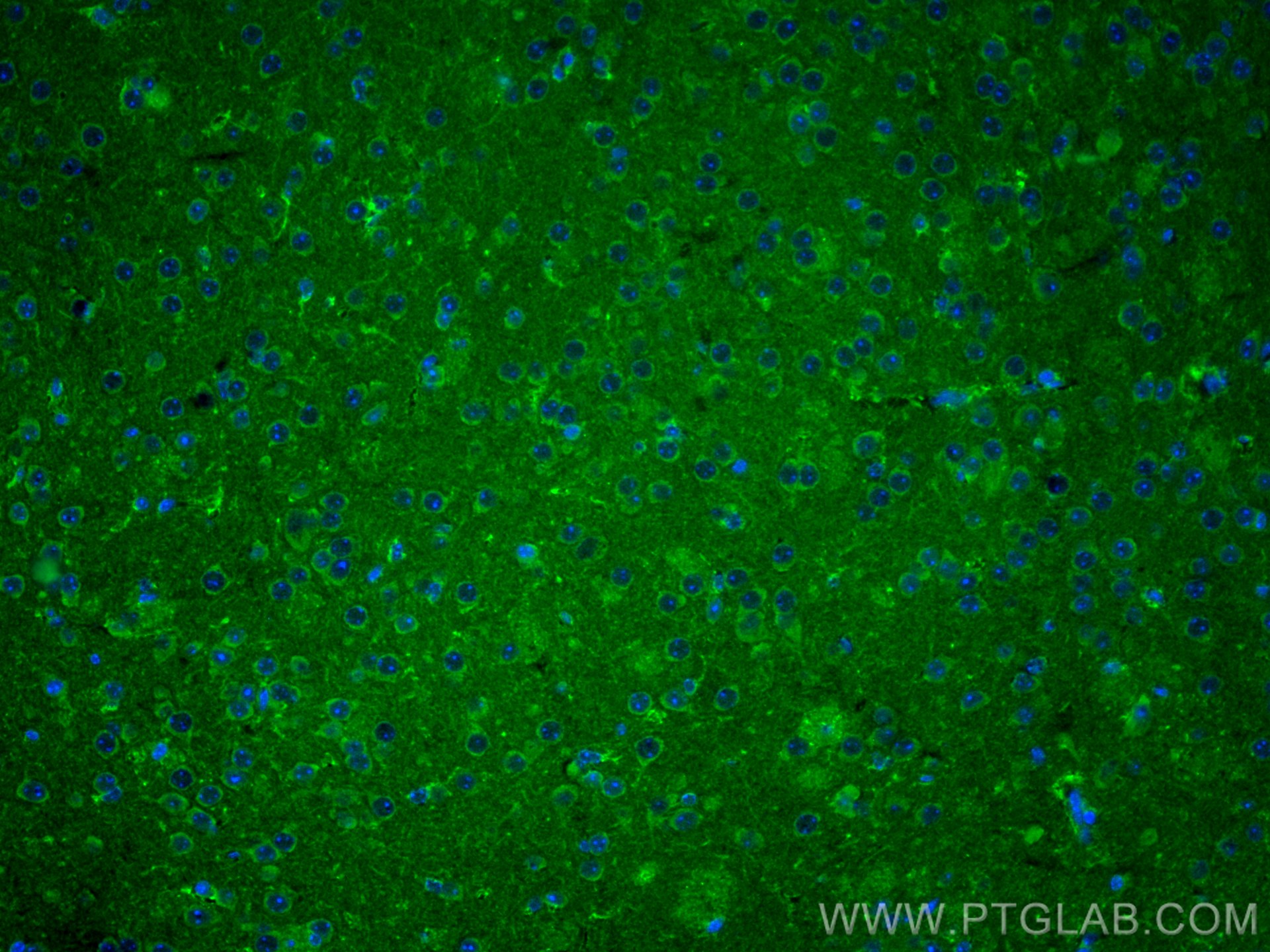 Immunofluorescence (IF) / fluorescent staining of mouse brain tissue using NRF2, NFE2L2 Polyclonal antibody (16396-1-AP)