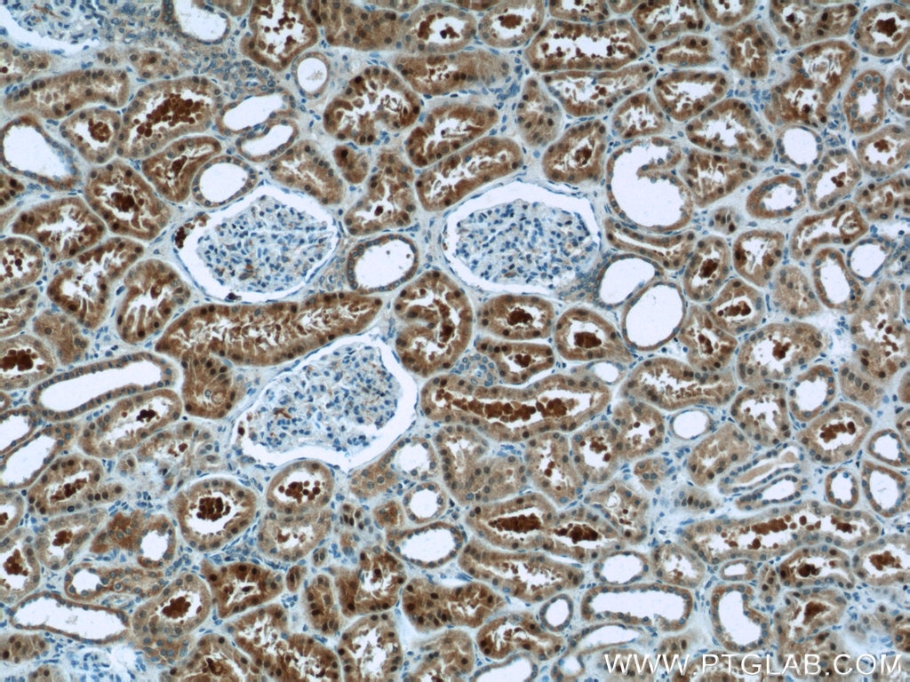 Immunohistochemistry (IHC) staining of human kidney tissue using NRF2, NFE2L2 Polyclonal antibody (16396-1-AP)