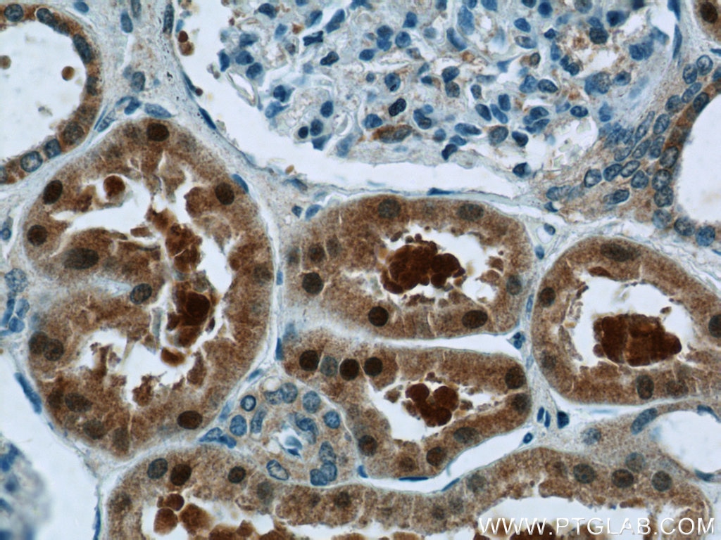 Immunohistochemistry (IHC) staining of human kidney tissue using NRF2, NFE2L2 Polyclonal antibody (16396-1-AP)