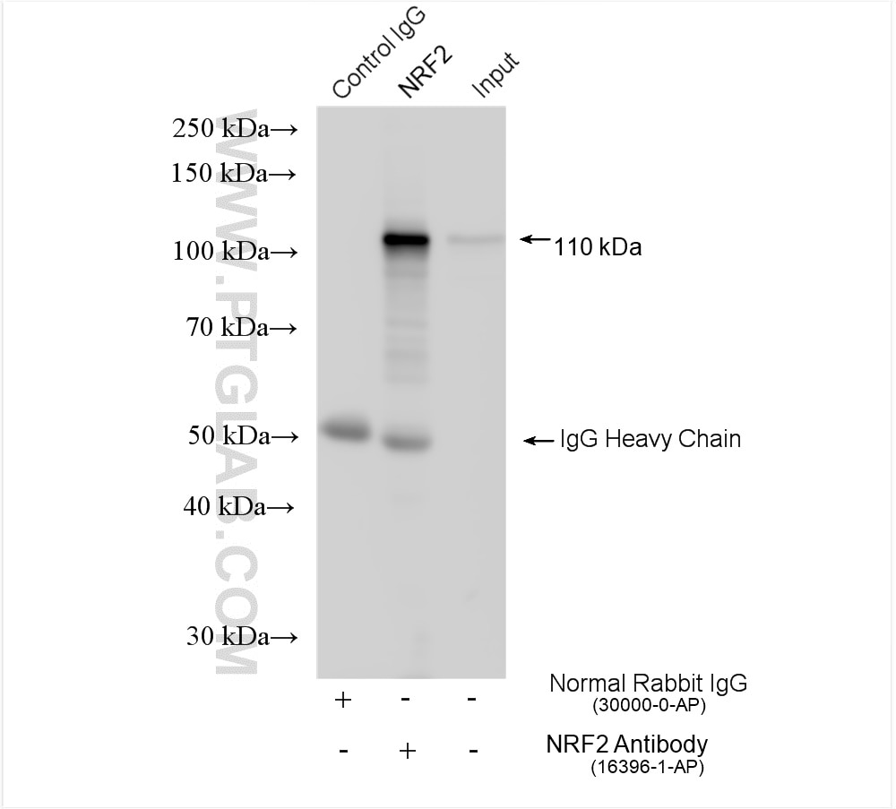 IP experiment of HeLa using 16396-1-AP