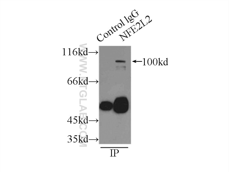 Immunoprecipitation (IP) experiment of mouse kidney tissue using NRF2, NFE2L2 Polyclonal antibody (16396-1-AP)