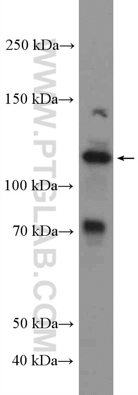 Western Blot (WB) analysis of HeLa cells using NRF2, NFE2L2 Polyclonal antibody (16396-1-AP)