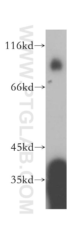 Western Blot (WB) analysis of human placenta tissue using NFE2L3 Polyclonal antibody (17745-1-AP)