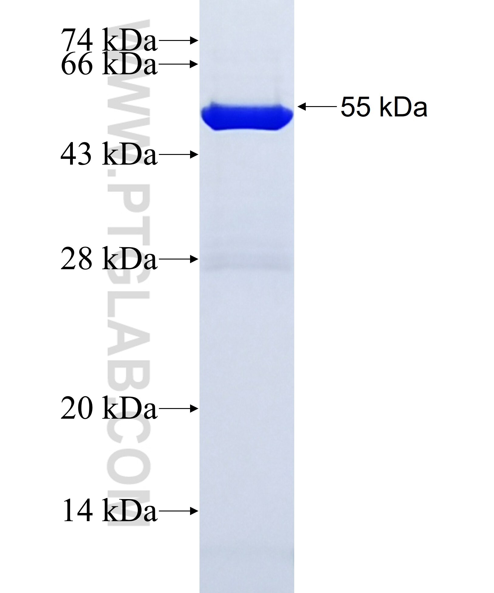 NFE2L3 fusion protein Ag29417 SDS-PAGE NFE2L3 fusion protein Ag29417 SDS-PAGE