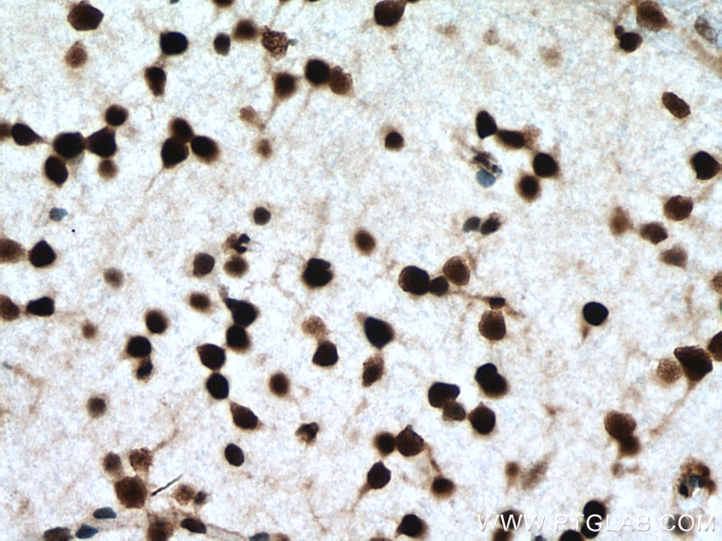 Immunohistochemistry (IHC) staining of mouse brain tissue using NFIA Polyclonal antibody (11750-1-AP)