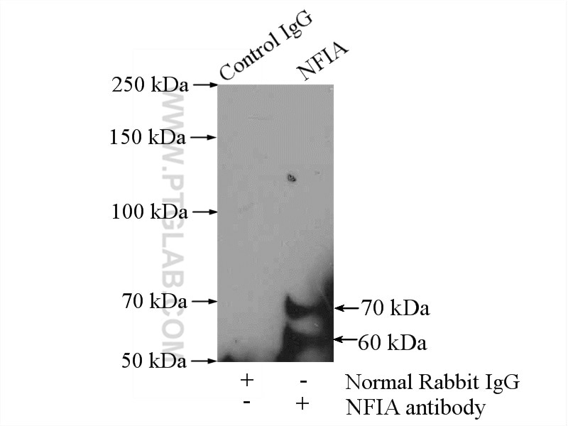 Immunoprecipitation (IP) experiment of A431 cells using NFIA Polyclonal antibody (11750-1-AP)