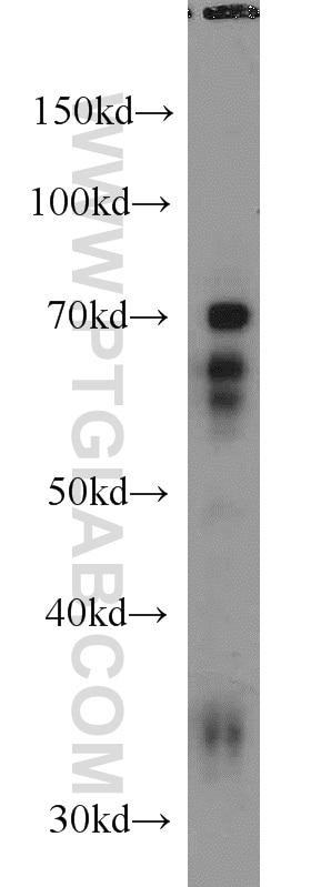 Western Blot (WB) analysis of HeLa cells using NFIA Polyclonal antibody (11750-1-AP)