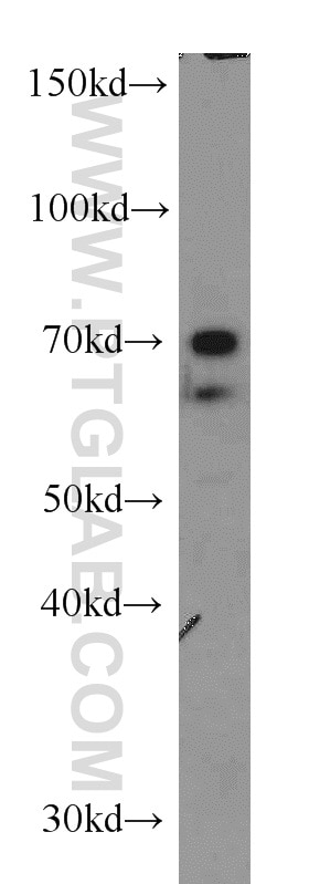 Western Blot (WB) analysis of A431 cells using NFIA Polyclonal antibody (11750-1-AP)