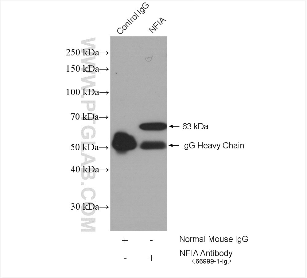 IP experiment of HeLa using 66999-1-Ig