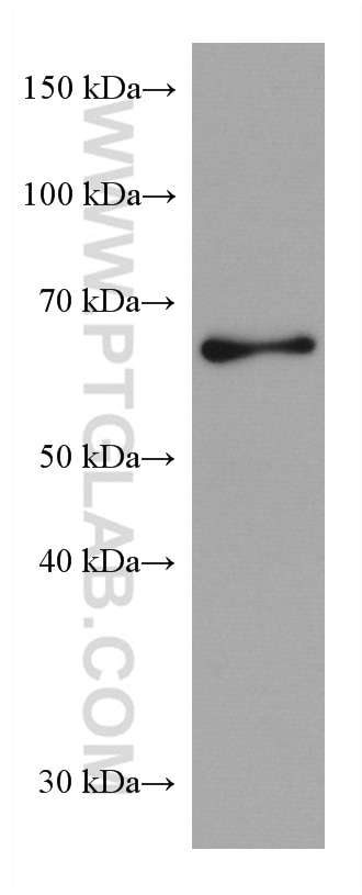 WB analysis of mouse cerebellum using 66999-1-Ig