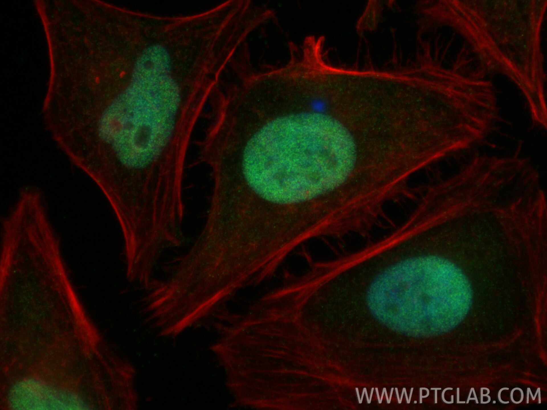 Immunofluorescence (IF) / fluorescent staining of HeLa cells using NFIB Polyclonal antibody (29898-1-AP)