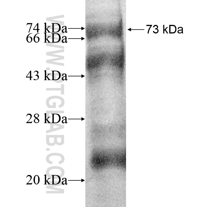 NFIB fusion protein Ag10165 SDS-PAGE
