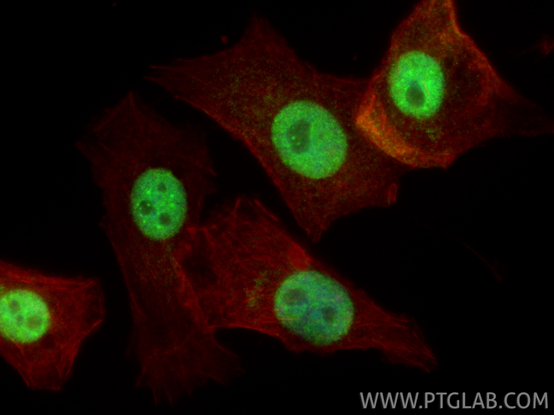 IF Staining of PC-3 using 16399-1-AP Immunofluorescence (IF) / fluorescent staining of PC-3 cells using NFIC Polyclonal antibody (16399-1-AP)