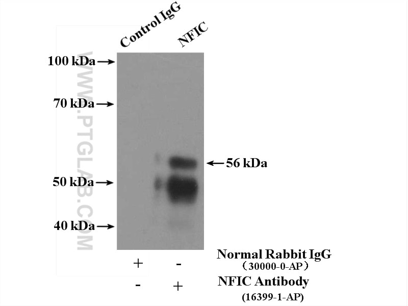 Immunoprecipitation (IP) experiment of HeLa cells using NFIC Polyclonal antibody (16399-1-AP)