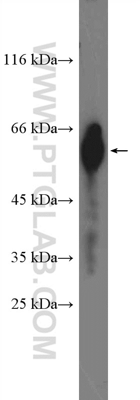 Western Blot (WB) analysis of PC-3 cells using NFIC Polyclonal antibody (16399-1-AP)