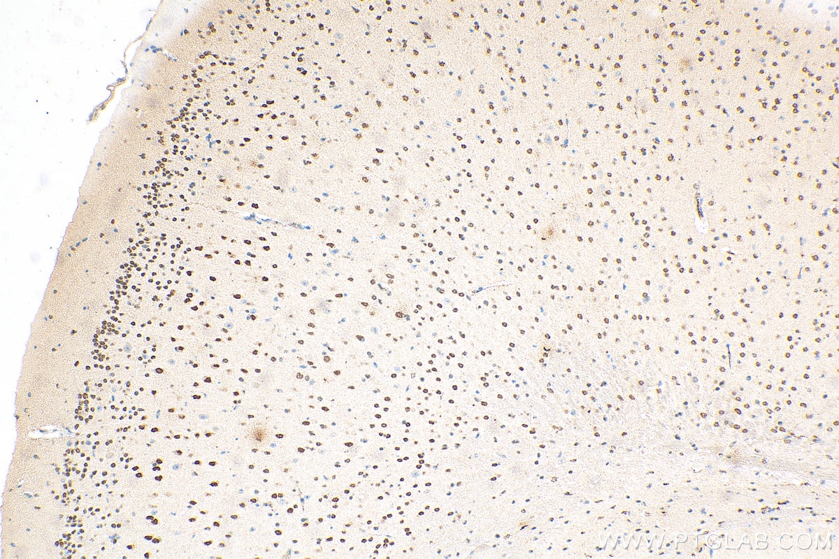 Immunohistochemistry (IHC) staining of mouse brain tissue using NFIX Monoclonal antibody (67983-1-Ig)