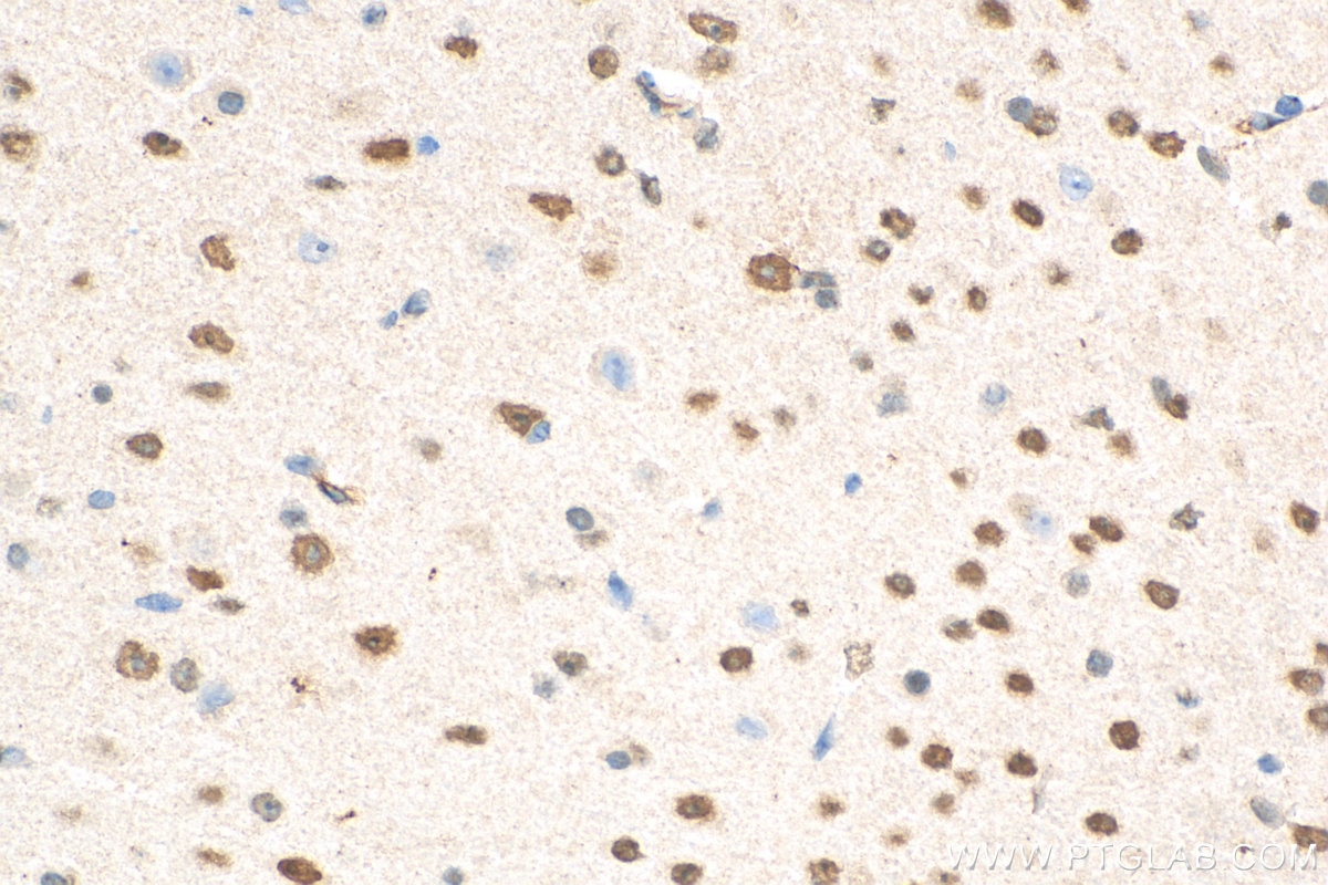 IHC staining of mouse brain using 67983-1-Ig