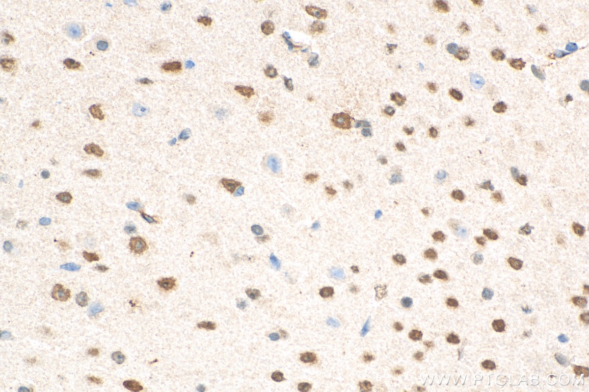 Immunohistochemistry (IHC) staining of mouse brain tissue using NFIX Monoclonal antibody (67983-1-Ig)