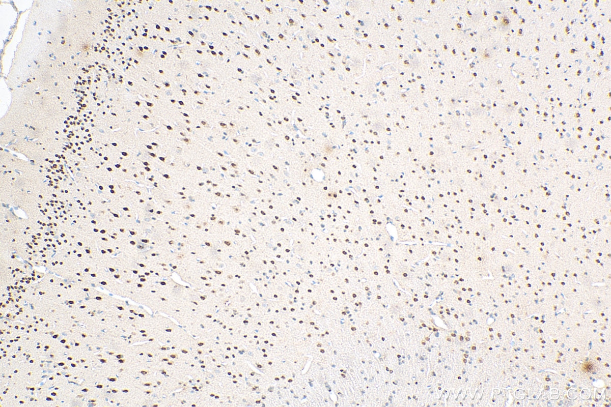 Immunohistochemistry (IHC) staining of rat brain tissue using NFIX Monoclonal antibody (67983-1-Ig)