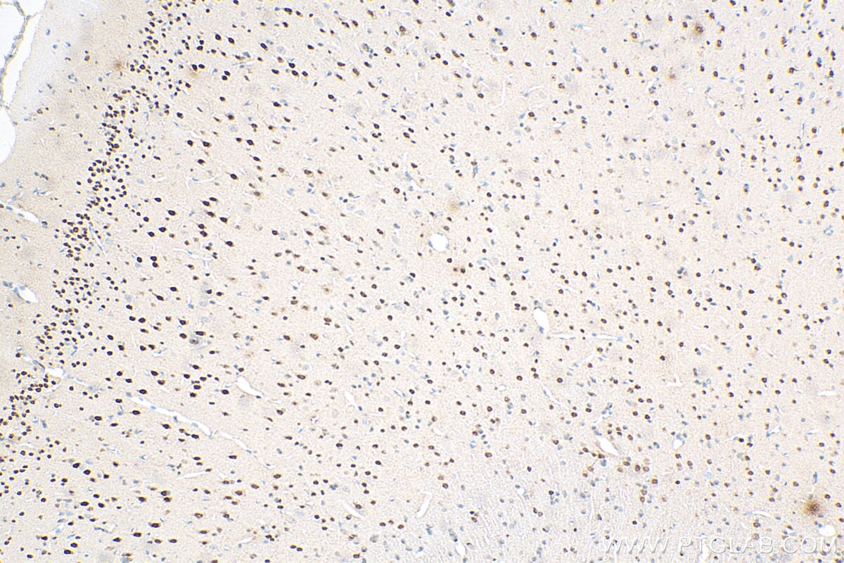 IHC staining of rat brain using 67983-1-Ig