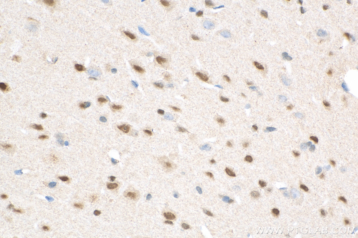 Immunohistochemistry (IHC) staining of rat brain tissue using NFIX Monoclonal antibody (67983-1-Ig)