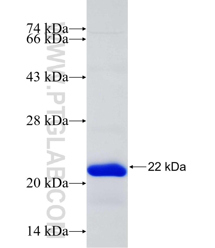 NFIX fusion protein Ag31447 SDS-PAGE
