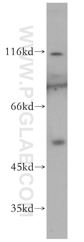 Western Blot (WB) analysis of Raji cells using NFKB1,p105,p50-Specific Polyclonal antibody (15506-1-AP)