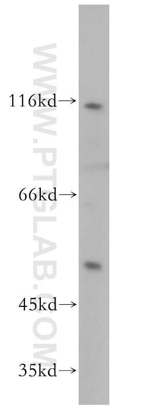 Western Blot (WB) analysis of A431 cells using NFKB1,p105,p50-Specific Polyclonal antibody (15506-1-AP)