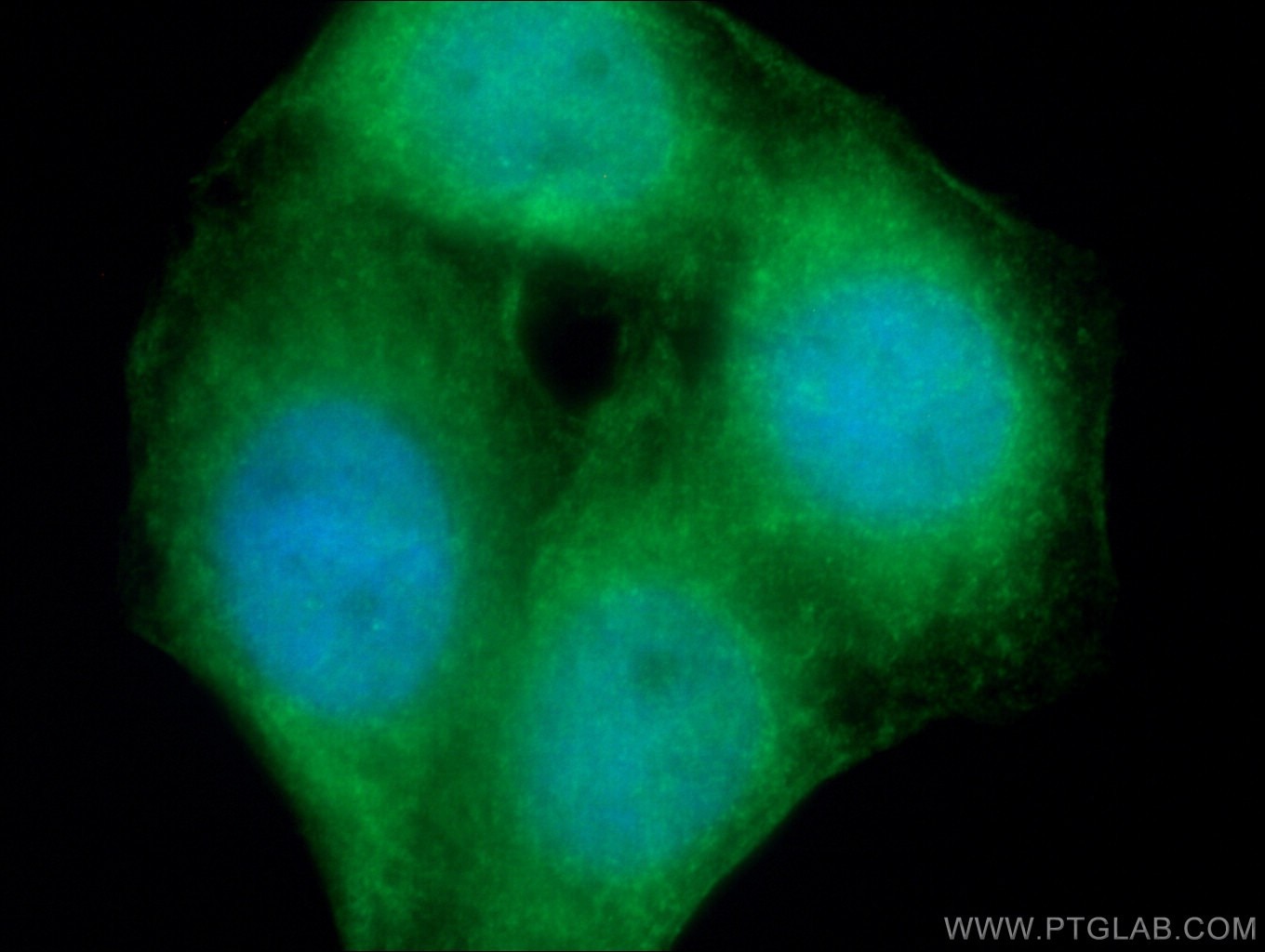 Immunofluorescence (IF) / fluorescent staining of HepG2 cells using NFKB1,p105,p50 Polyclonal antibody (14220-1-AP)