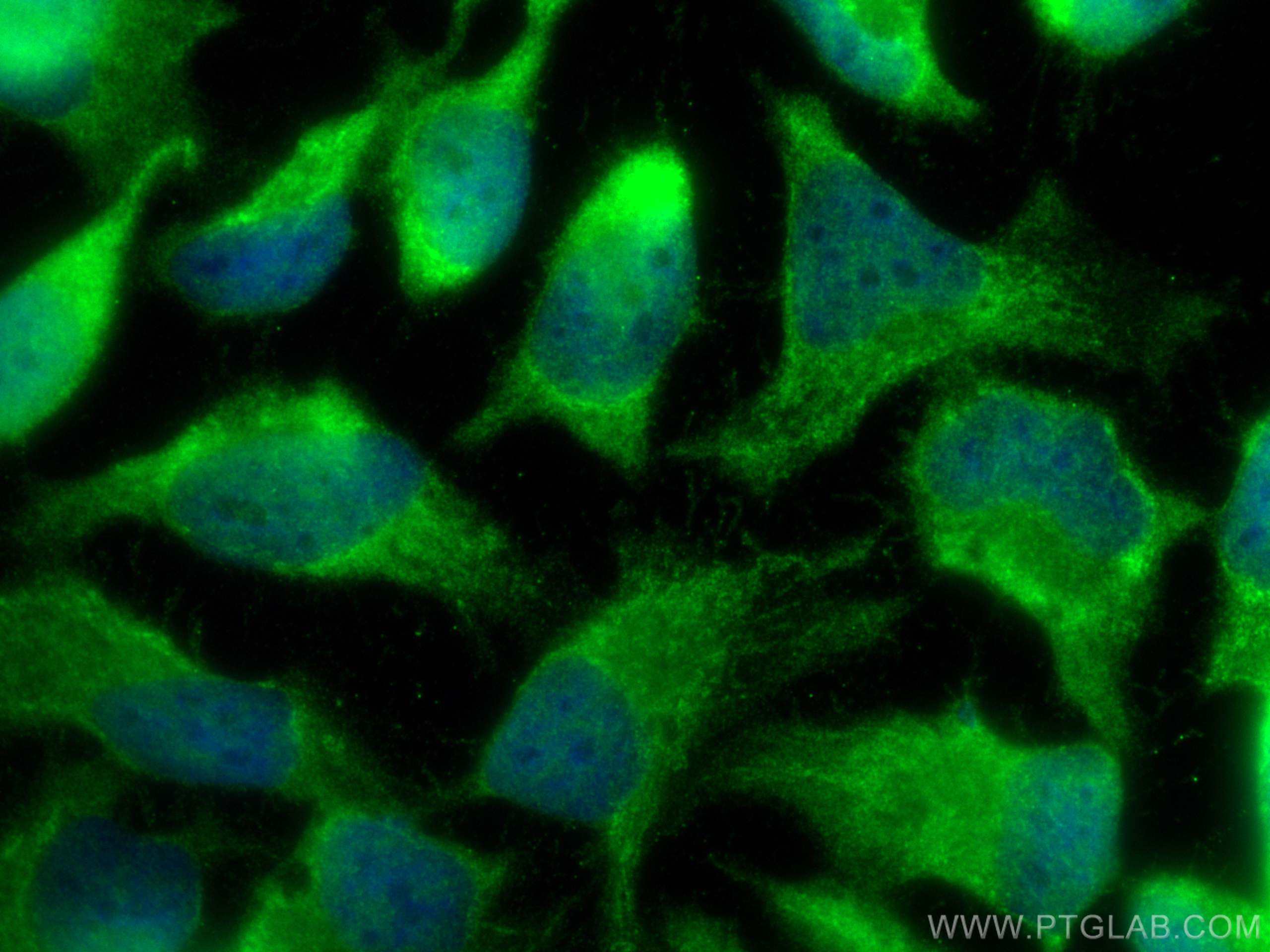 Immunofluorescence (IF) / fluorescent staining of HeLa cells using NFKB1,p105,p50 Polyclonal antibody (14220-1-AP)