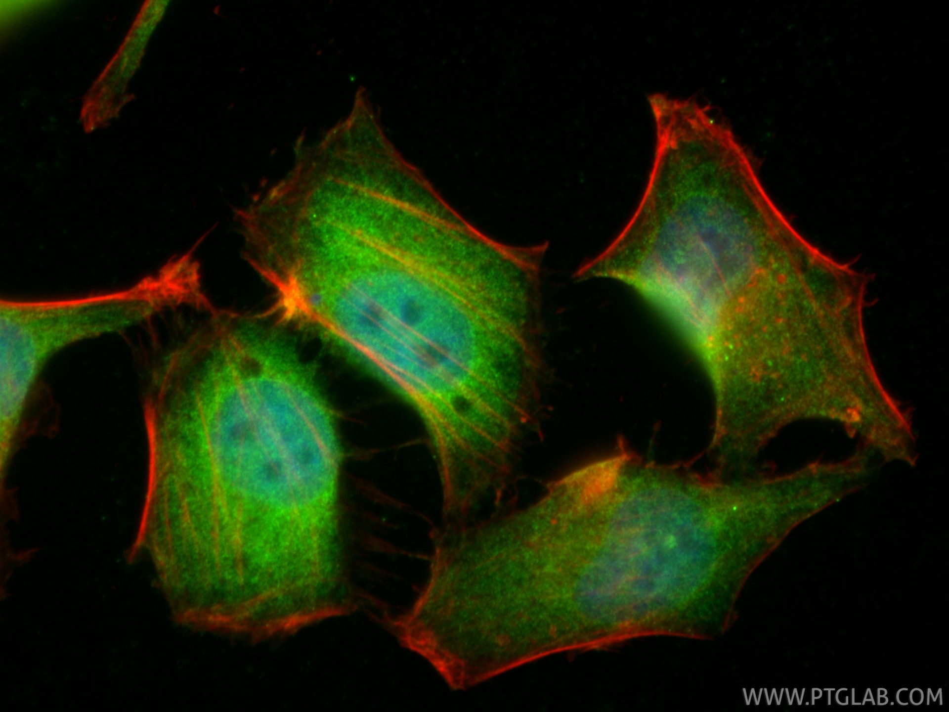 IF Staining of HepG2 using 14220-1-AP Immunofluorescence (IF) / fluorescent staining of HepG2 cells using NFKB1 p105/p50 Polyclonal antibody (14220-1-AP)
