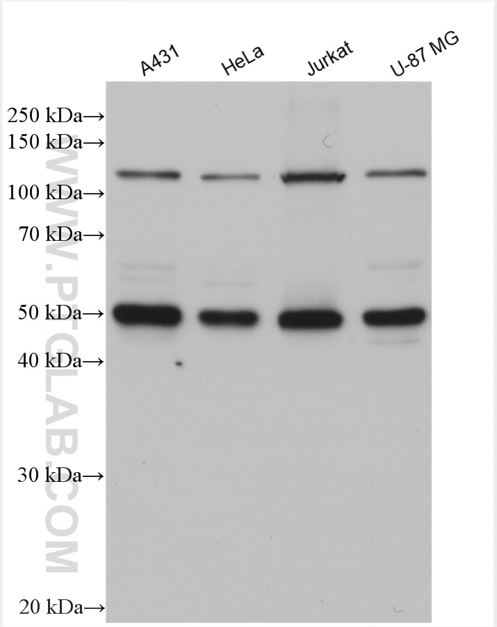 Western Blot (WB) analysis of various lysates using NFKB1 Polyclonal antibody (14220-1-AP)