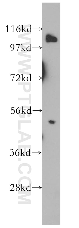 NFKB1,p105,p50 Polyclonal antibody