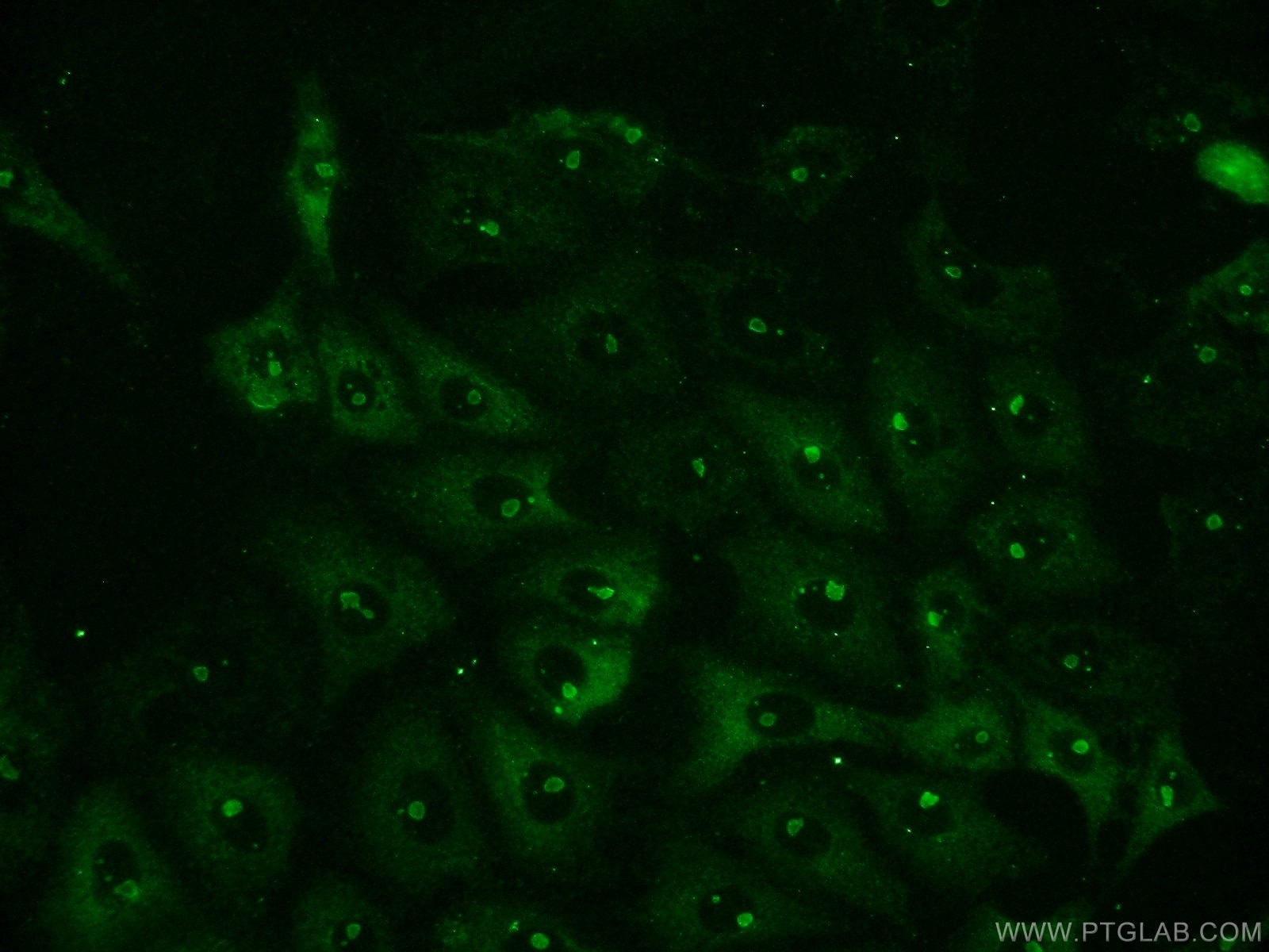 Immunofluorescence (IF) / fluorescent staining of SH-SY5Y cells using NFKB1,p105 Polyclonal antibody (23576-1-AP)