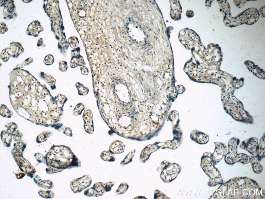 Immunohistochemistry (IHC) staining of human placenta tissue using NFKB1,p105 Polyclonal antibody (23576-1-AP)