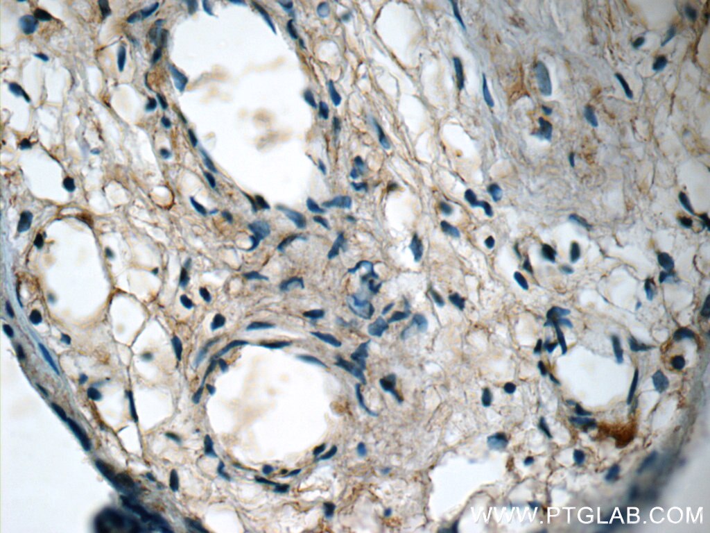 IHC staining of human placenta using 23576-1-AP