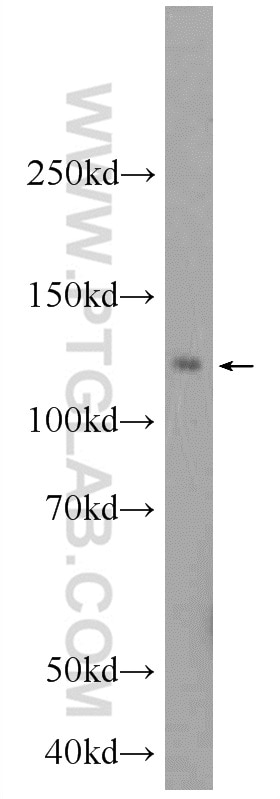 Western Blot (WB) analysis of HeLa cells using NFKB1,p105 Polyclonal antibody (23576-1-AP)