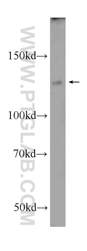 Western Blot (WB) analysis of Jurkat cells using NFKB1,p105 Polyclonal antibody (23576-1-AP)