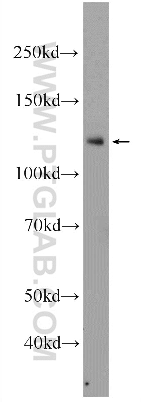 Western Blot (WB) analysis of K-562 cells using NFKB1,p105 Polyclonal antibody (23576-1-AP)
