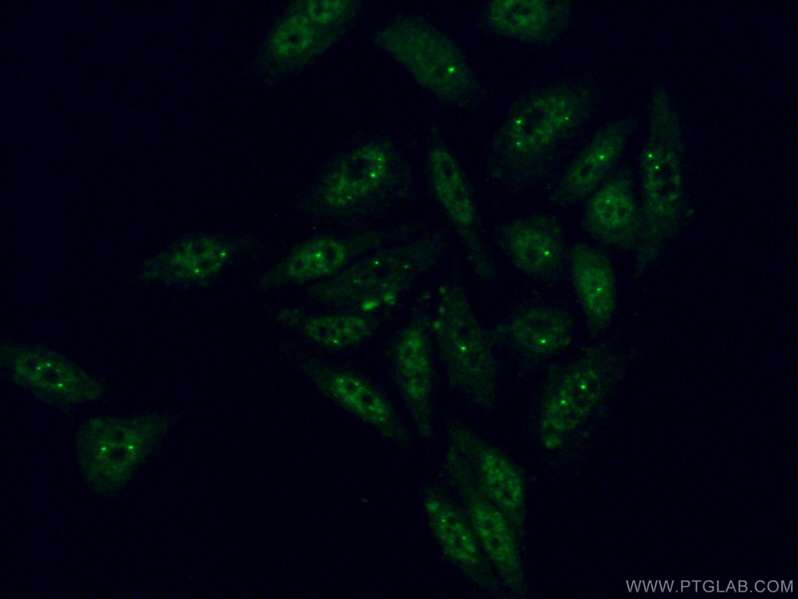 IF Staining of HepG2 using 66992-1-Ig