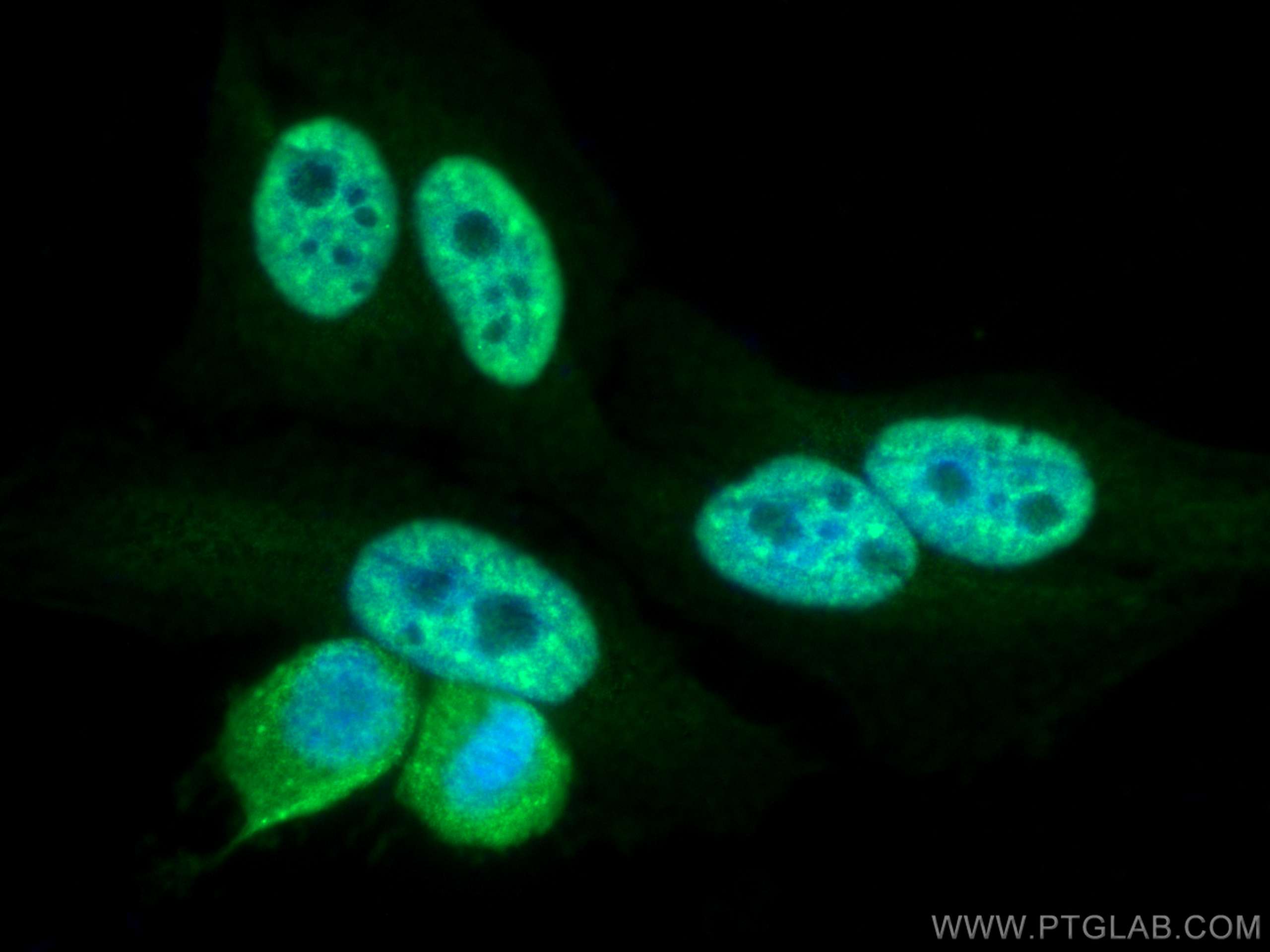 Immunofluorescence (IF) / fluorescent staining of HepG2 cells using NFKB1,p105,p50 Monoclonal antibody (66992-1-Ig)