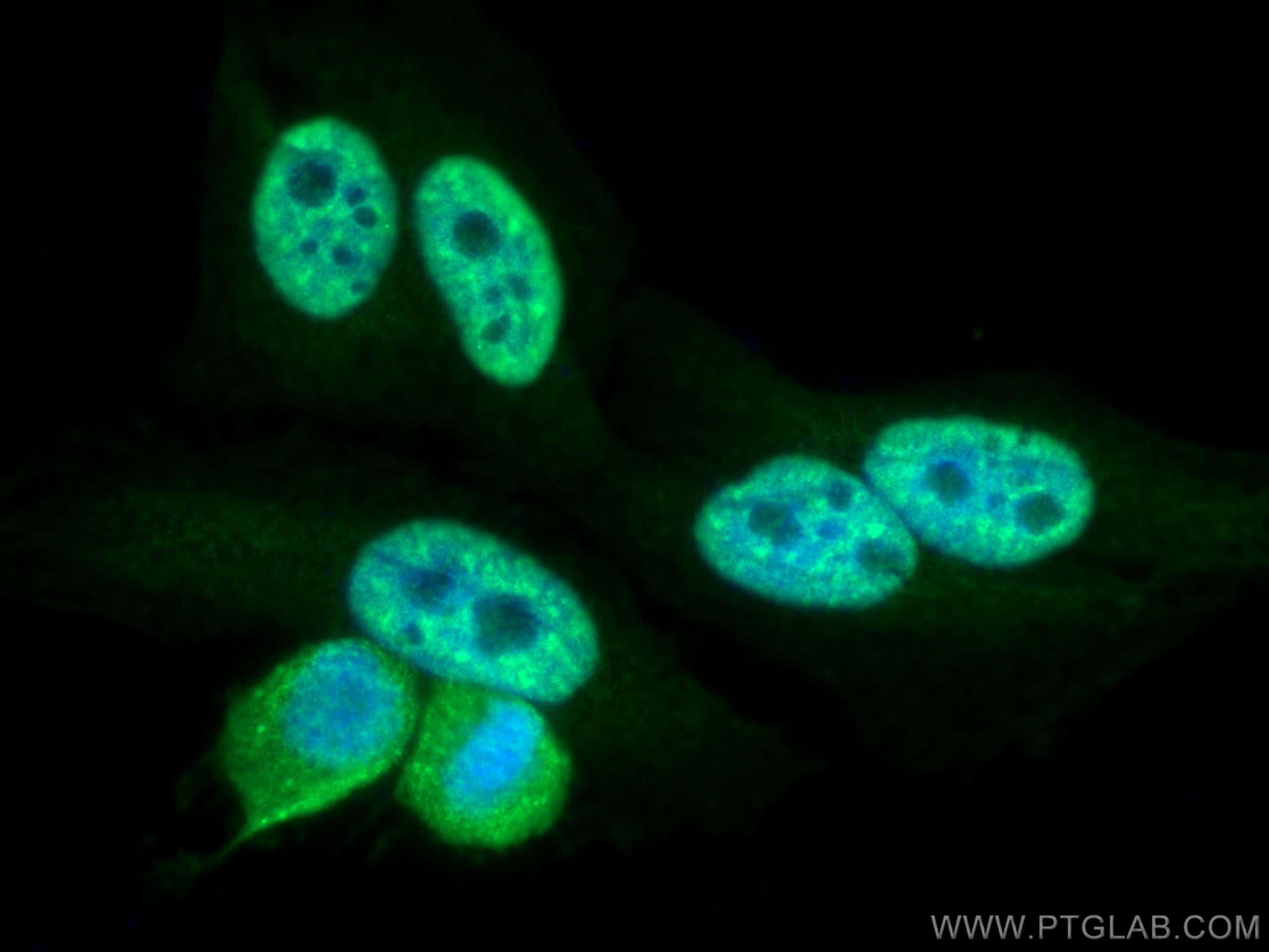 IF Staining of HepG2 using 66992-1-Ig