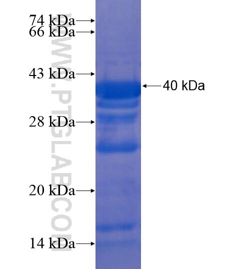 NFKB1 fusion protein Ag20361 SDS-PAGE