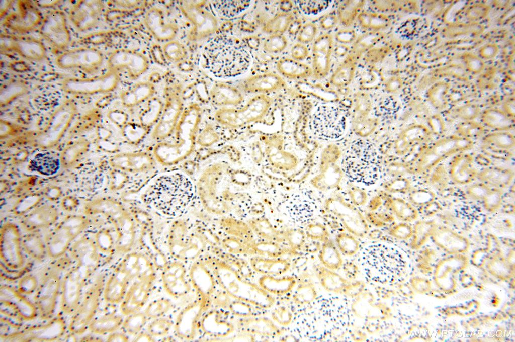 IHC staining of human kidney using 15503-1-AP