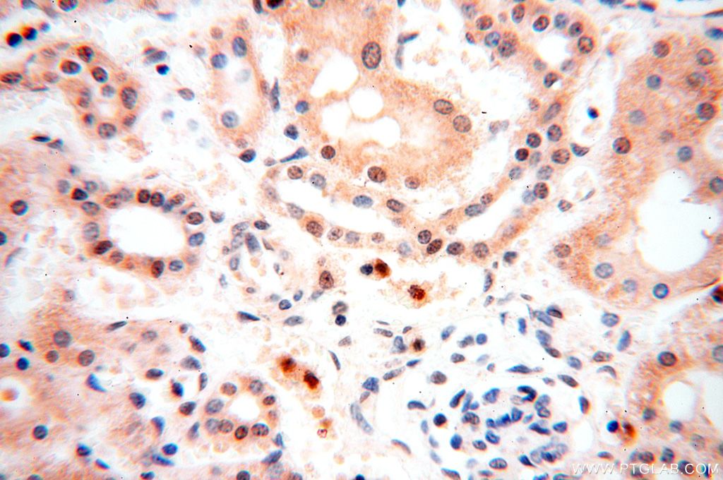 Immunohistochemistry (IHC) staining of human kidney tissue using NFKB2,p52,p100-Specific Polyclonal antibody (15503-1-AP)