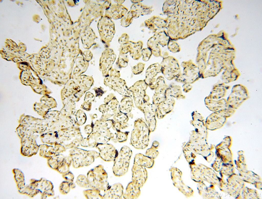 Immunohistochemistry (IHC) staining of human placenta tissue using NFKB2,p52,p100-Specific Polyclonal antibody (15503-1-AP)